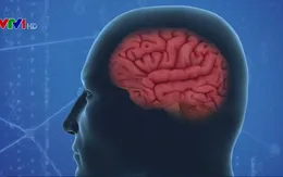 Hy vọng mới trong điều trị Alzheimer