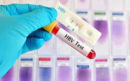 Xét nghiệm viêm gan B miễn phí tại Hà Nội
