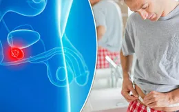 Triệu chứng cảnh báo ung thư tuyến tiền liệt giai đoạn đầu