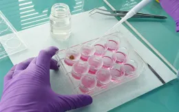 Đột phá mới trong công nghệ tế bào tái tạo da chữa lành vết thương