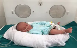 Lào Cai: Các bác sĩ cứu sống thành công hàng chục trẻ sinh non ở huyện biên giới