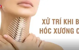 Bị hóc xương cá, cần làm những gì?