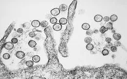 Dịch virus Hanta lây lan tại Argentina khiến 9 người thiệt mạng