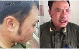 Nhân viên an ninh sân bay Nội Bài bị hành hung