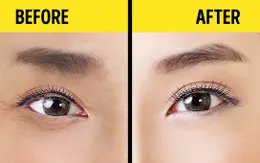 Kỹ thuật massage giúp trẻ hóa đôi mắt chỉ trong 1 phút