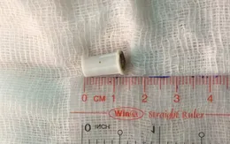 Hóc đầu kèn nhựa, bé trai 6 tuổi ở Đồng Nai suýt chết