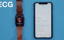 FDA cấp phép sản phẩm thiết bị điện tâm đồ mới