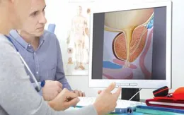 Phương pháp điều trị phì đại tuyến tiền liệt trong 10 phút, không cần phãu thuật