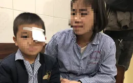 Cảnh báo trẻ chơi đùa nguy hiểm gây tổn thương mắt