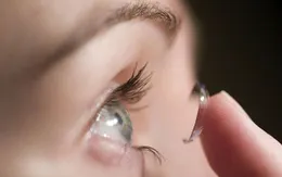 Dùng kính áp tròng thay cho tiêm trong điều trị bệnh mắt