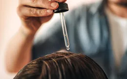 Bỏ túi 8 bí kíp ngăn ngừa gàu hiệu quả trong mùa hanh khô