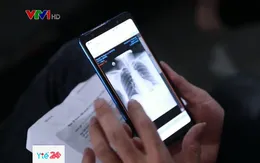 Bệnh viện số hóa hình ảnh phim chụp