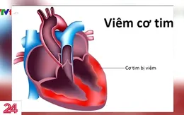 Chưa ghi nhận dịch virus viêm cơ tim