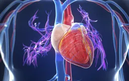 Cứu sống bệnh nhân bị viêm cơ tim cấp có biến chứng suy tim
