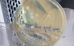 Bộ Y tế khuyến cáo phòng bệnh Whitmore