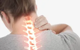 Stress dễ gây đau cột sống cổ
