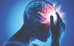 Cảnh báo nguy cơ đột quỵ khi thời tiết chuyển lạnh