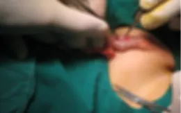 Bé trai ở Vũng Tàu mắc dị tật chỉ ghi nhận 36 ca trên thế giới
