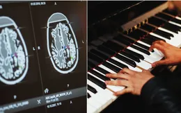 Bệnh nhân chơi piano trong lúc được mổ não