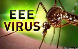 Virus viêm não do muỗi lây lan rộng ở Michigan, Mỹ