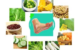 Chế độ ăn uống hợp lý cho người bệnh gout trong những ngày Tết