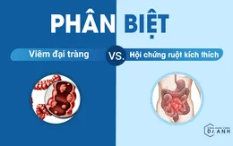 Viêm đại tràng và hội chứng ruột kích thích: Đừng nhầm lẫn nếu chưa hiểu rõ!