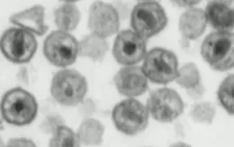 Chủng mới của virus HIV có thể là thách thức cho các xét nghiệm chẩn đoán