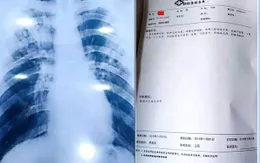 Muốn nghỉ phép dài, giáo viên mua bệnh án mắc lao giả qua mạng