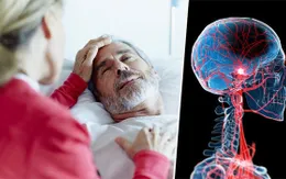 Nhiệt độ Trái đất tăng làm tăng nguy cơ đột quỵ ở người lớn tuổi