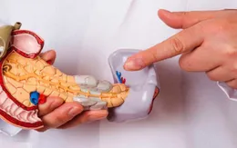Thuốc làm tiêu biến khối u ung thư tuyến tụy trong 14 ngày