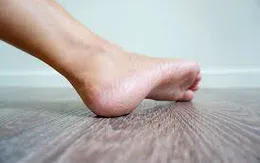 Bảo vệ làn da khỏi bị nứt, nẻ mùa hanh khô
