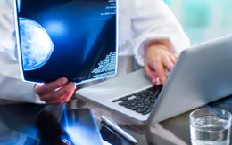 AI giúp sàng lọc ung thư vú tốt hơn các phương pháp hiện hành