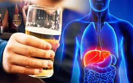 Tìm ra cách  đảo ngược bệnh viêm gan do rượu bia
