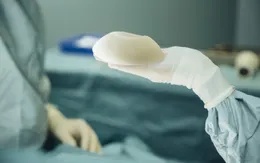 Hàn Quốc ghi nhận 2 ca ung thư hiếm gặp liên quan phẫu thuật nâng ngực