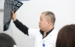 25% ca đột quỵ não xảy ra ở những người trẻ tuổi