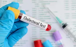 Lợi ích của điều trị sớm tình trạng cholesterol cao