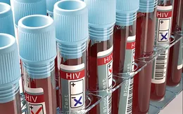 Sẽ có vaccine ngừa HIV vào năm 2021