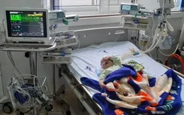 Cứu bé 5 tháng tuổi sốc tim, nhiễm trùng huyết nguy kịch