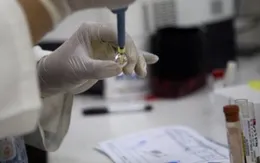 Australia điều chế vaccine phòng chống dị ứng lạc