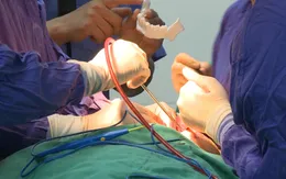 Thay khớp thái dương hàm toàn phần