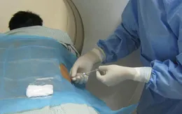 Cây kim 800 nghìn giúp bệnh nhân ung thư hết đau