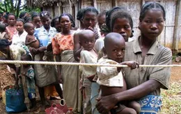 Madagascar: Gần 1.000 trẻ em tử vong vì bệnh sởi trong 4 tháng gần đây