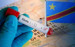 Tăng cường phòng chống bệnh do virus Ebola