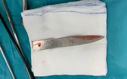 Cứu nam thanh niên bị dao đâm gãy cán nằm trong lồng ngực