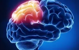Nguy cơ mắc bệnh tâm thần phân liệt não của thanh thiếu niên