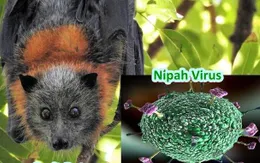Đẩy nhanh nghiên cứu vaccine ngừa virus Nipah gây tổn thương não bộ