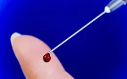 Thiết bị đột phá giúp phát hiện ung thư chỉ qua một giọt máu
