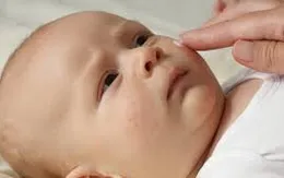Chăm sóc da cho trẻ mùa hanh khô