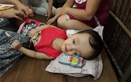 Mở rộng hỗ trợ mổ não úng thủy cho trẻ em