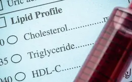 Thuốc giảm Cholesterol dạng viên – lựa chọn mới cho những người sử dụng nhóm thuốc Statin